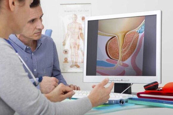 The doctor consults the patient about prostatitis
