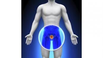 Male prostatitis