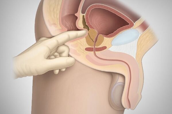 Prostate massage to treat bacterial prostatitis
