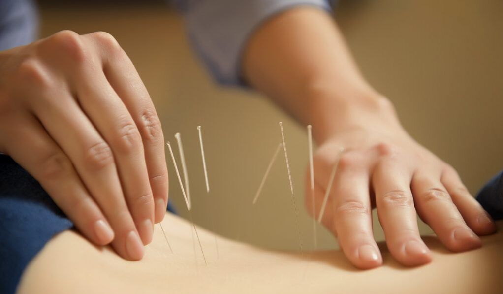 Acupuncture is a common treatment for chronic prostatitis