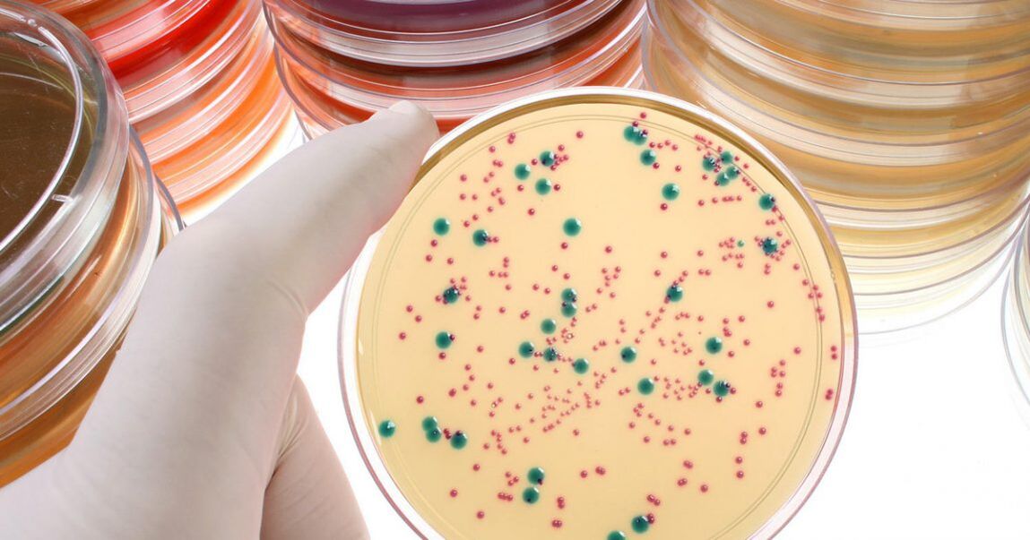 Detection of bacterial chronic prostatitis by analyzing urine and prostate secretions